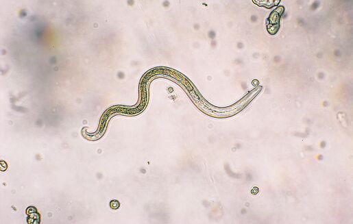 a pinwormok fertőzőek